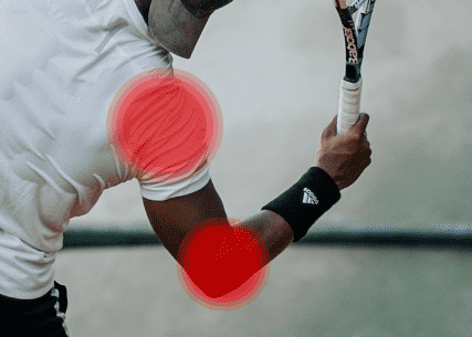 dolor de codo y hombro por tendinitis en deporte de raqueta: tenis, pádel, squash, golf
