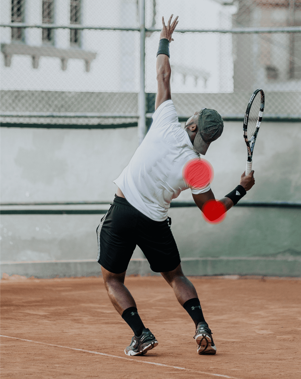 dolor de codo y hombro por tendinitis en deporte de raqueta: tenis, pádel, squash, golf